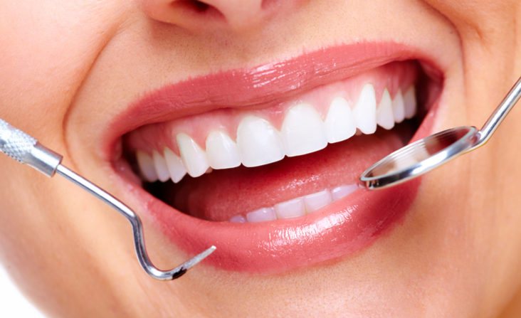 girl smiling cosmetic dentistry veneers teeth whitening