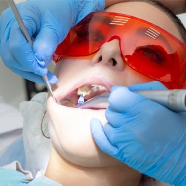 All-On-4® Dental Implants3
